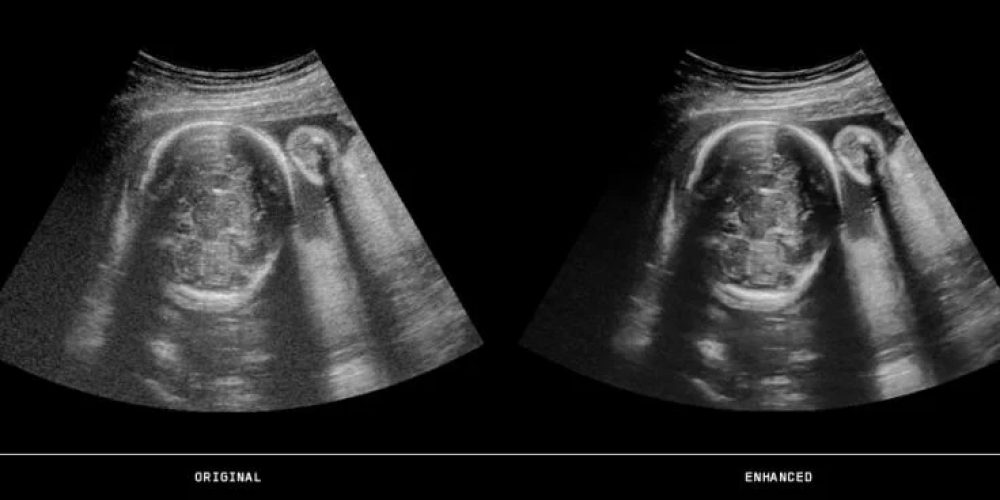 A fake ultrasound is the easiest method to educate your partner what you wish